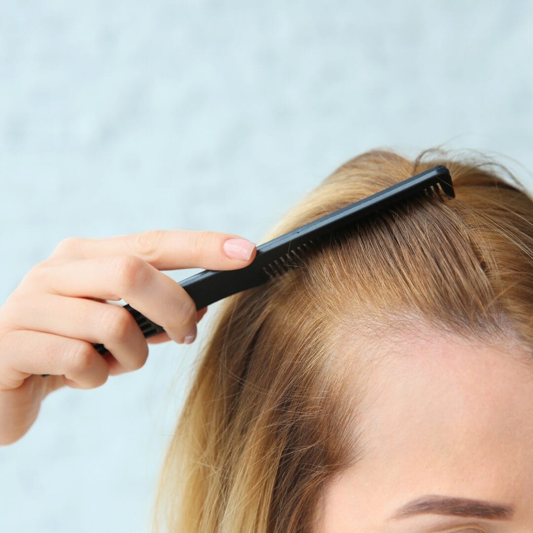 woman combing hair with a patch missing from hair line